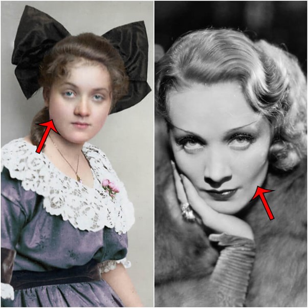Marlene Dietrich ถอนฟันกรามของเธอออกเพื่อเน้นโหนกแก้มของเธอ